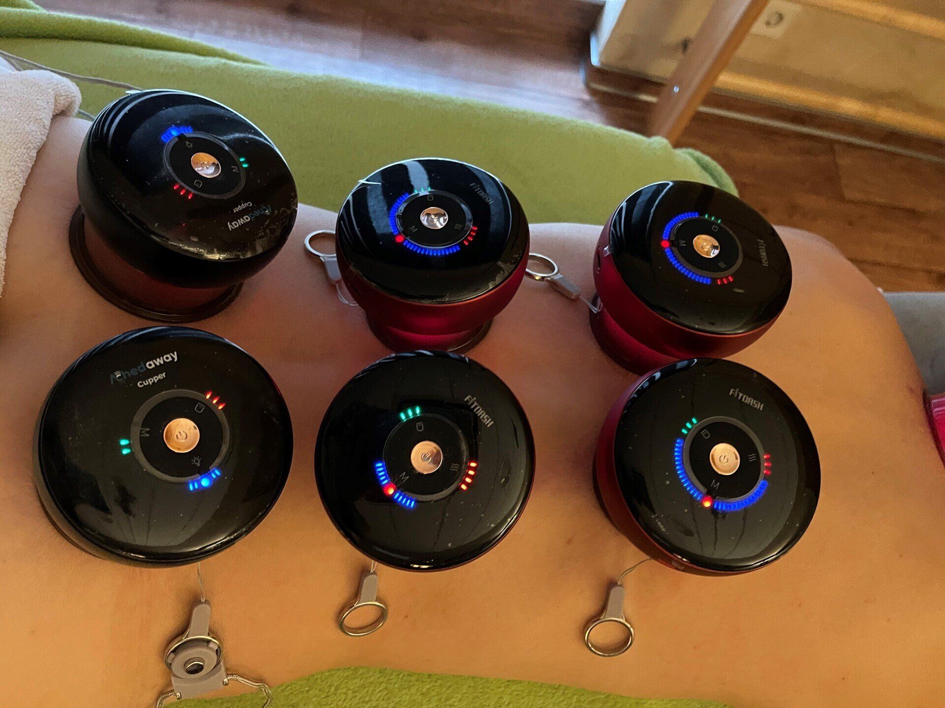 Traditionelles Heilverfahren im hochmodernen Gewand in Hannover