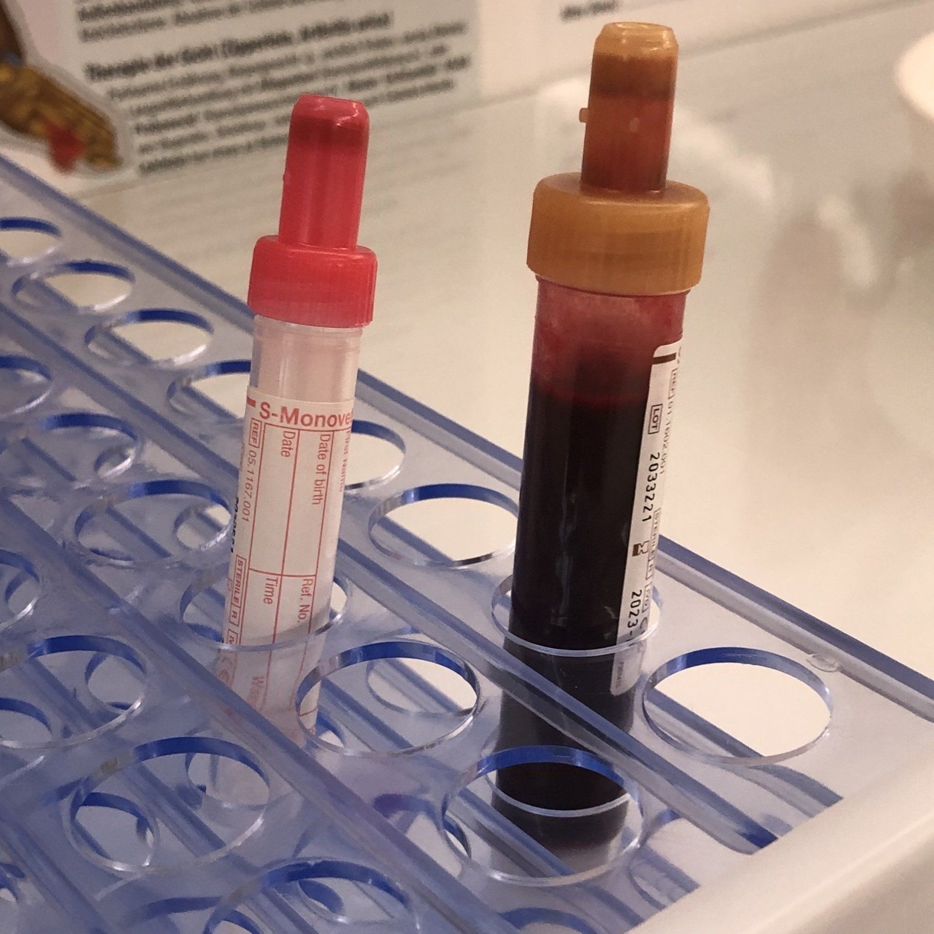 Labordiagnostik, Blutuntersuchungen, Speicheltests in Winnenden und Ludwigsburg, Naturheilpraxis Diana Rahn