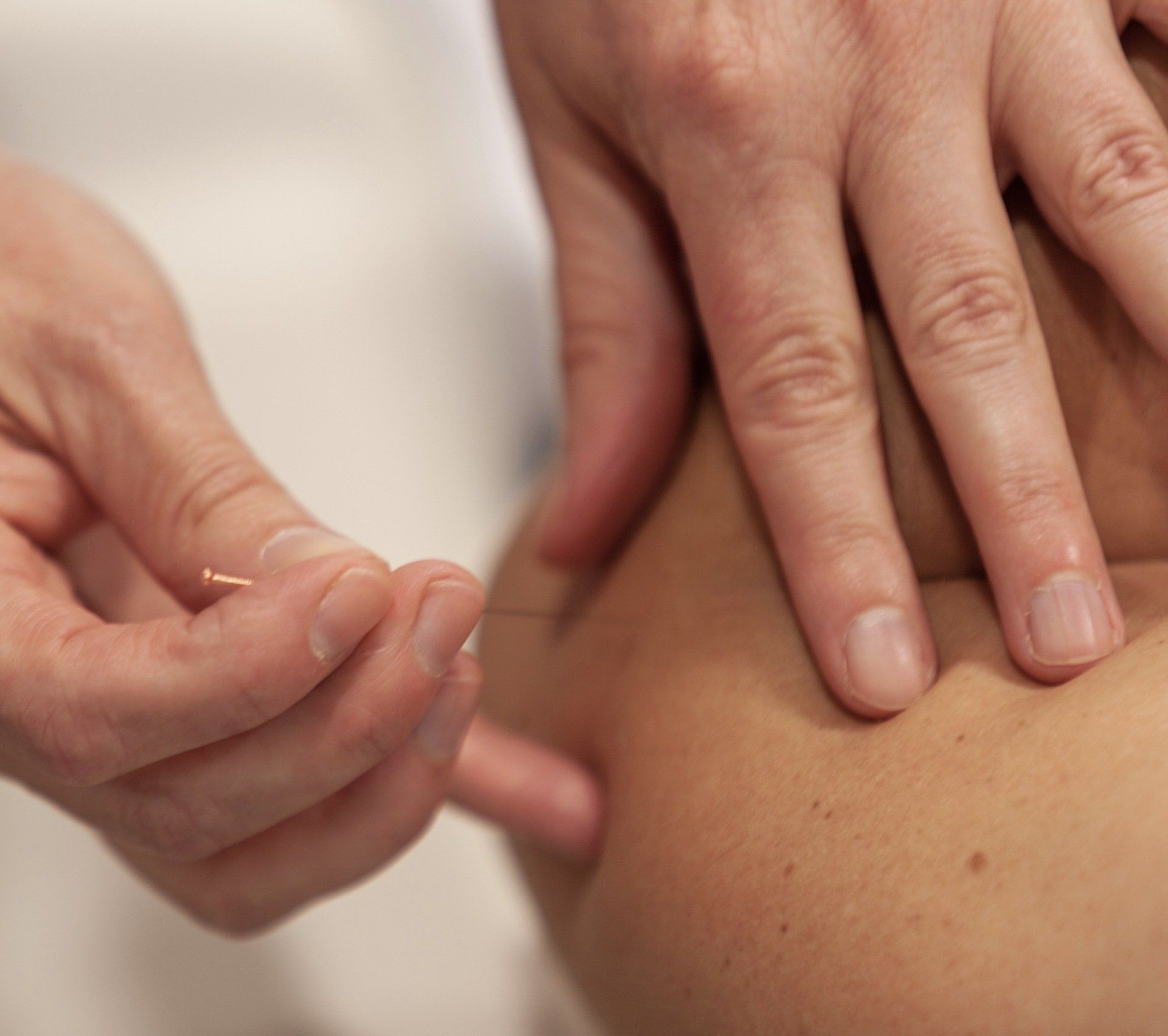 Akupunktur in Winnenden und Ludwigsburg, Naturheilpraxis Diana Rahn