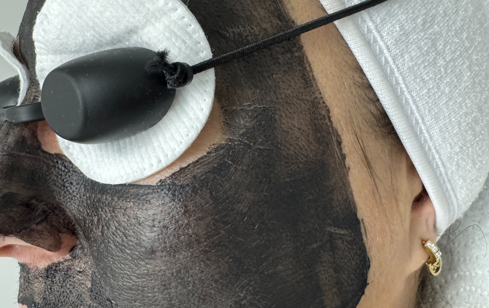 Carbon Peeling Salzburg