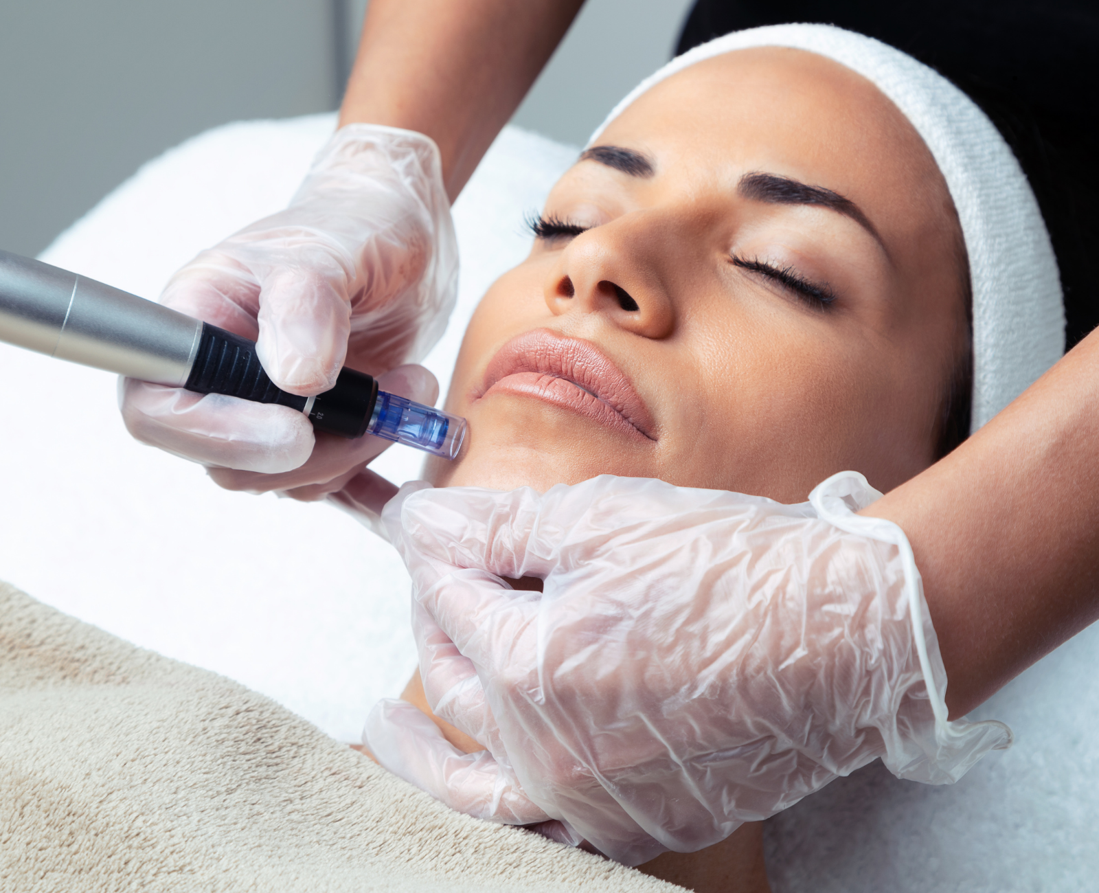 Microneedling salzburg & Hallein