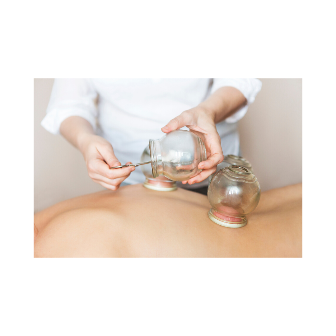 practitioner applying glass cupping set to a patient