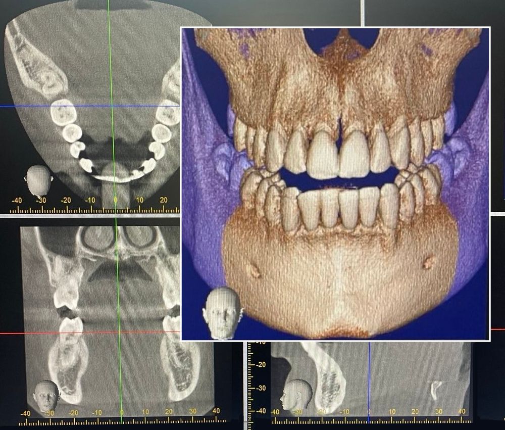 3D-Röntgen 3D-Röntgen