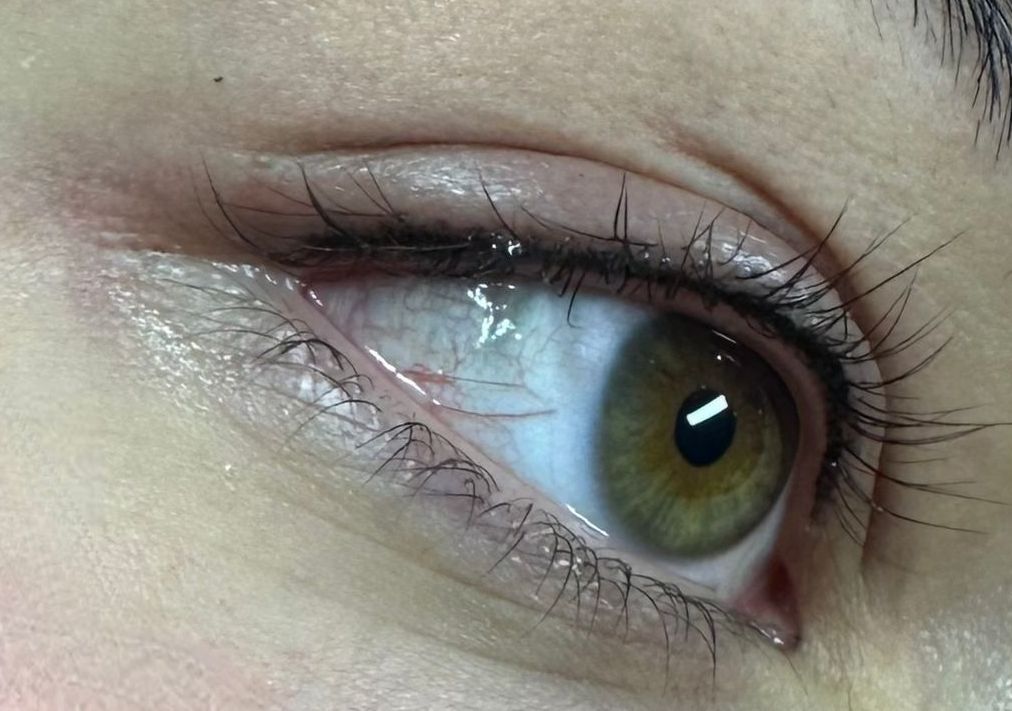 Neuanlage inkl. einer Nacharbeit innerhalb von 4 Wochen 250,00 Euro; Fresh up innerhalb von 12 Monaten 100,00 Euro; Fresh up innerhalb von 24 Monaten 149,00 Euro Neuanlage inkl. einer Nacharbeit innerhalb von 4 Wochen 250,00 Euro;
Fresh up innerhalb von 12 Monaten 100,00 Euro;
Fresh up innerhalb von 24 Monaten 149,00 Euro