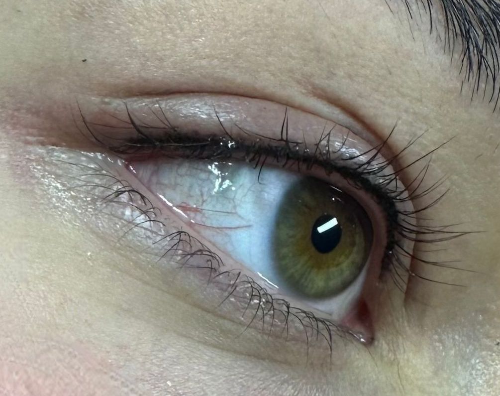 Neuanlage inkl. einer Nacharbeit innerhalb von 4 Wochen 250,00 Euro; Fresh up innerhalb von 12 Monaten 100,00 Euro; Fresh up innerhalb von 24 Monaten 149,00 Euro Neuanlage inkl. einer Nacharbeit innerhalb von 4 Wochen 250,00 Euro;
Fresh up innerhalb von 12 Monaten 100,00 Euro;
Fresh up innerhalb von 24 Monaten 149,00 Euro