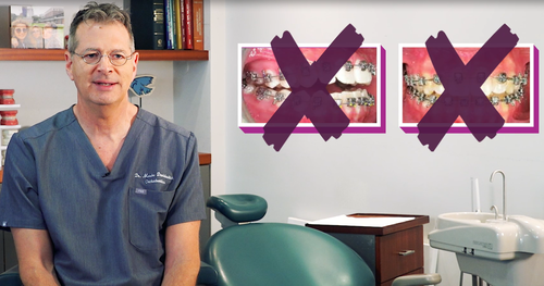 triamond reduced mechanics