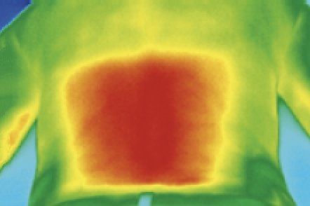 Lasertherapie Rücken