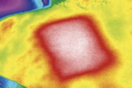 Schulterblatt nach Lasertherapie