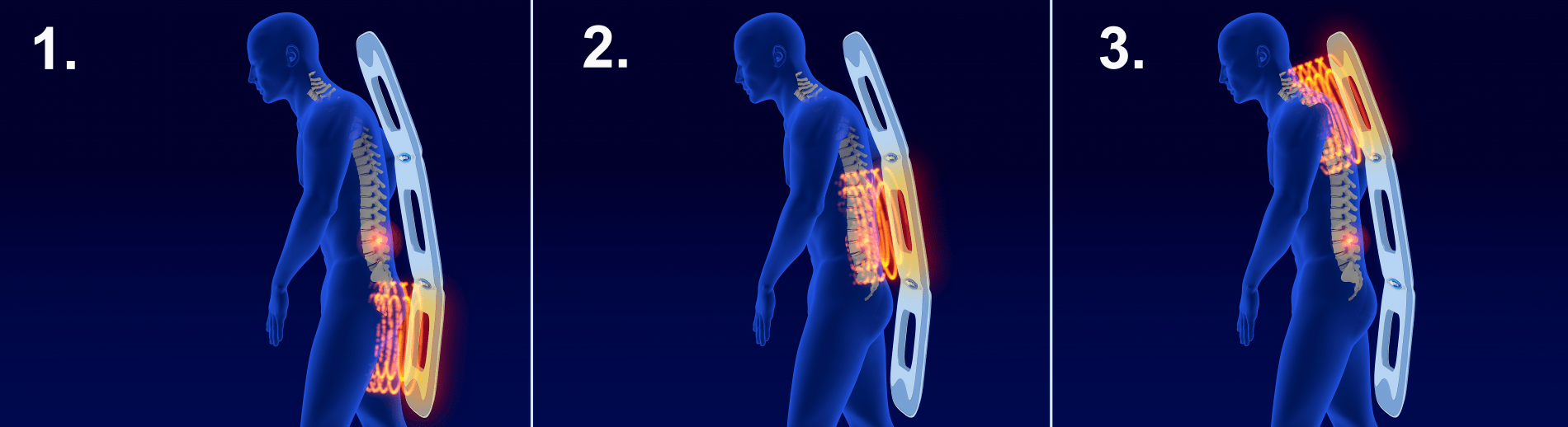 Aplicadores de magnetoterapia