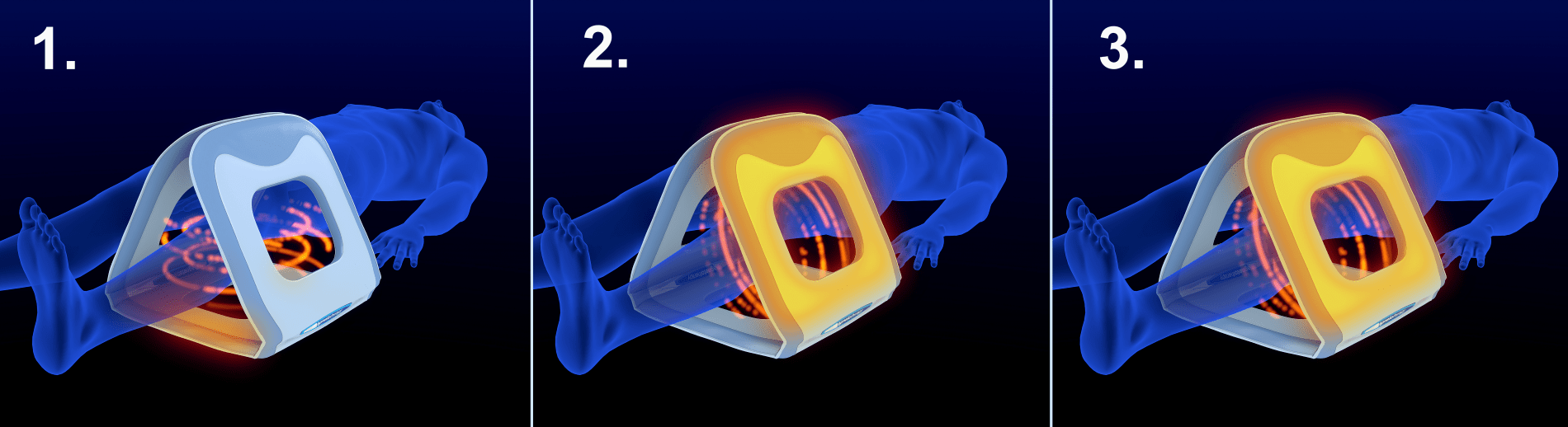 Alquiler de aplicadores de magnetoterapia
