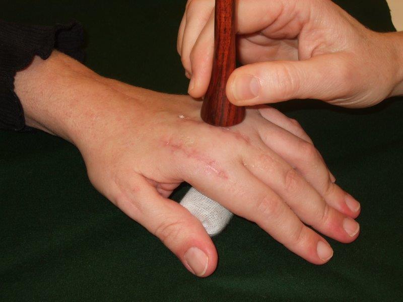 ÖGH Therapiemittel Handfunktion