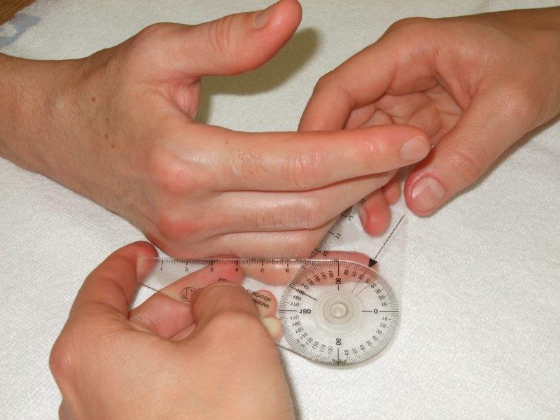 ÖGH Therapiemittel Handfunktion