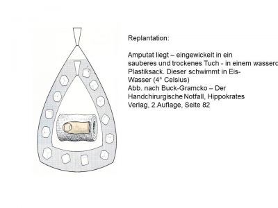 ÖGH Replantation