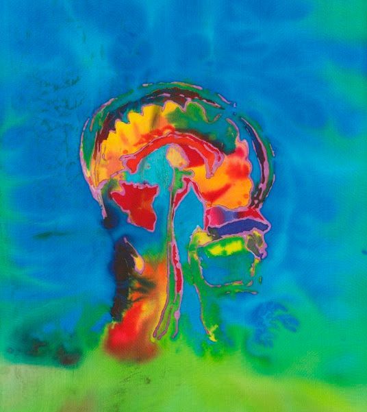 Neuroplastizität, Neuromodulation und Neurostimulation