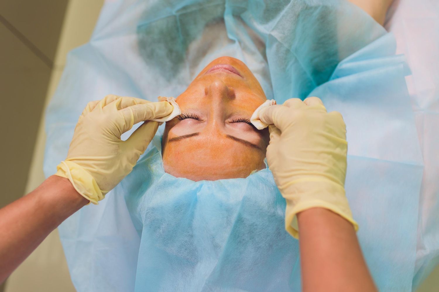 Endolift ou lifting chirurgical ? Découvrez les différences, indications, résultats et alternatives