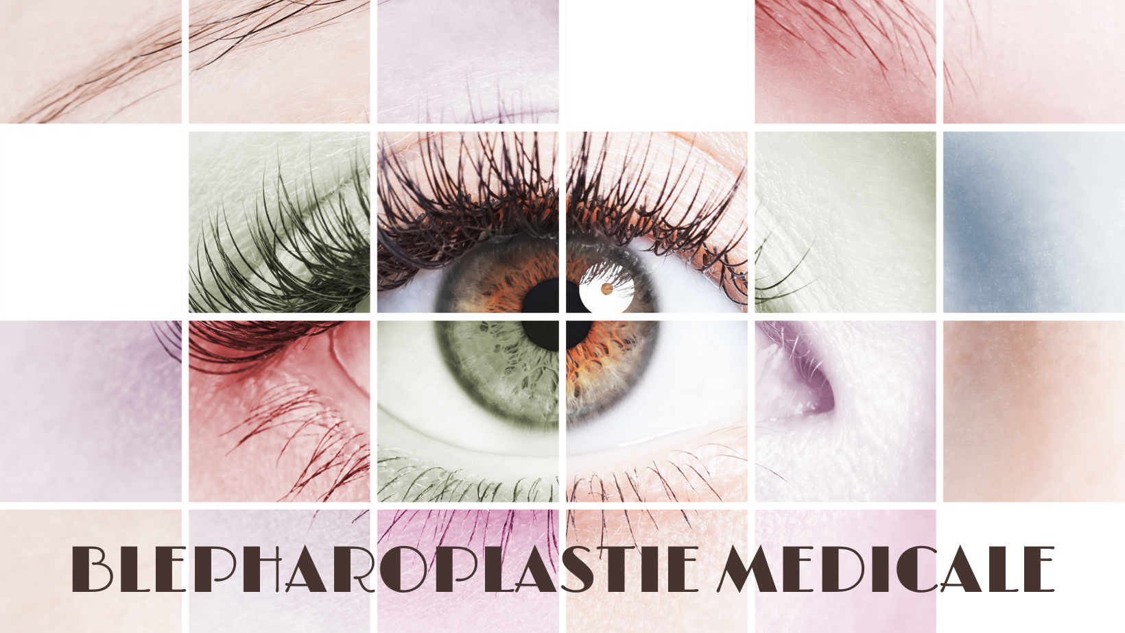 blepharoplastie medicale
