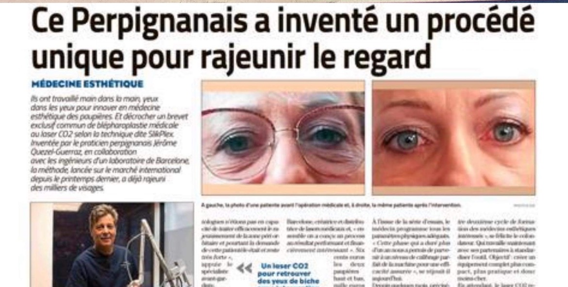 blepharoplastie medicale brevet docteur jerome quezel guerraz
