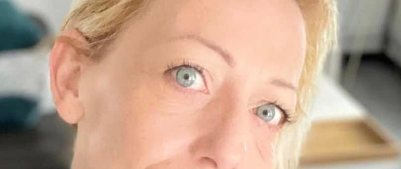 blépharoplastie médicale sans chirurgie