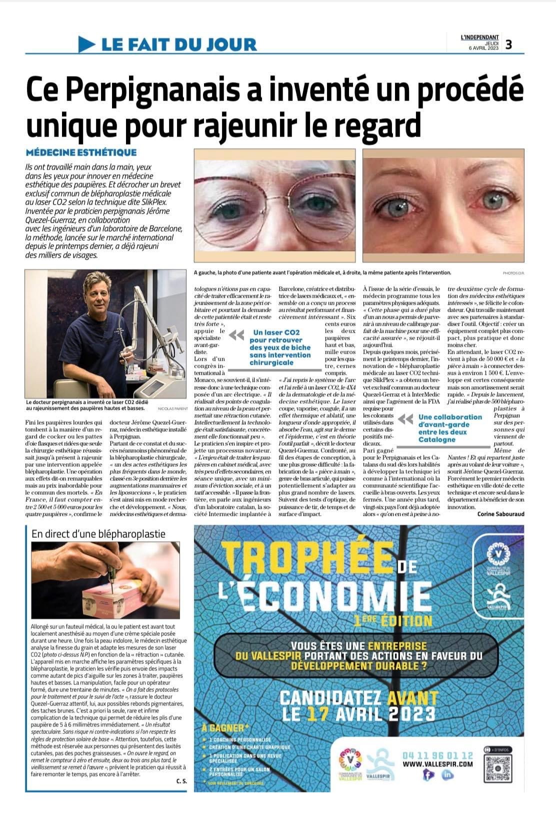 blepharoplastie du docteur quezel guerraz