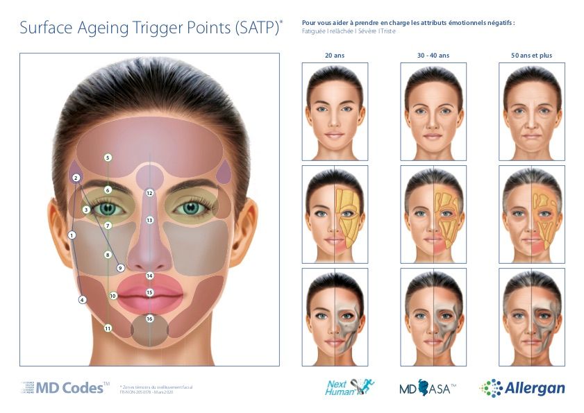 Md codes zones d'injection