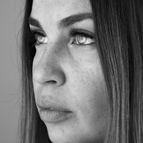rajeunissement du regard