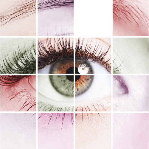 image de belle femme blepharoplastie medicale