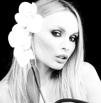 mini lifting sans chirurgie