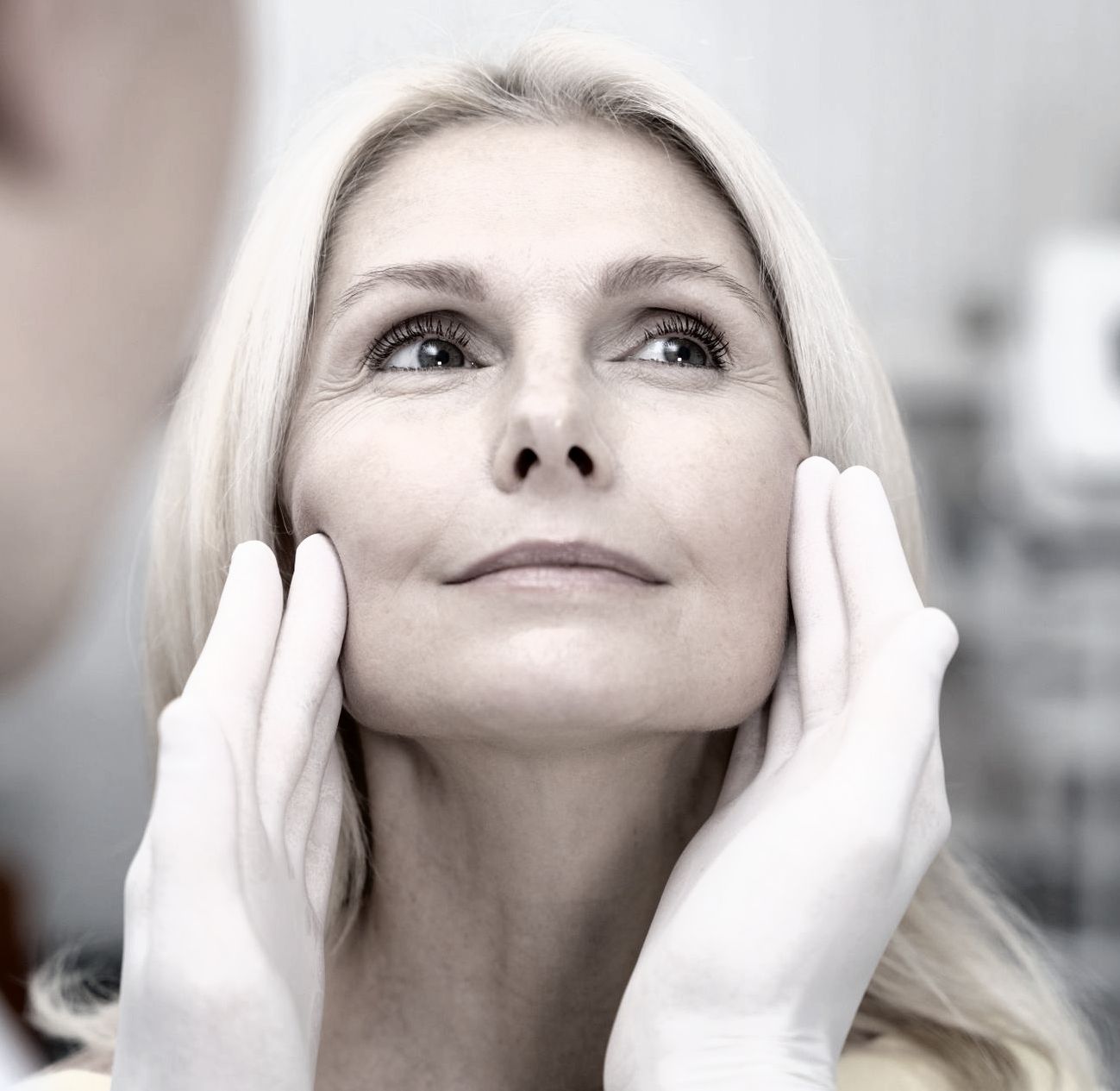 femme avec lifting par fils tenseurs