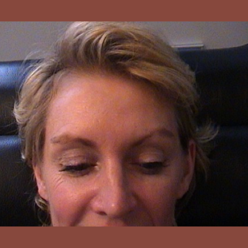 apres botox