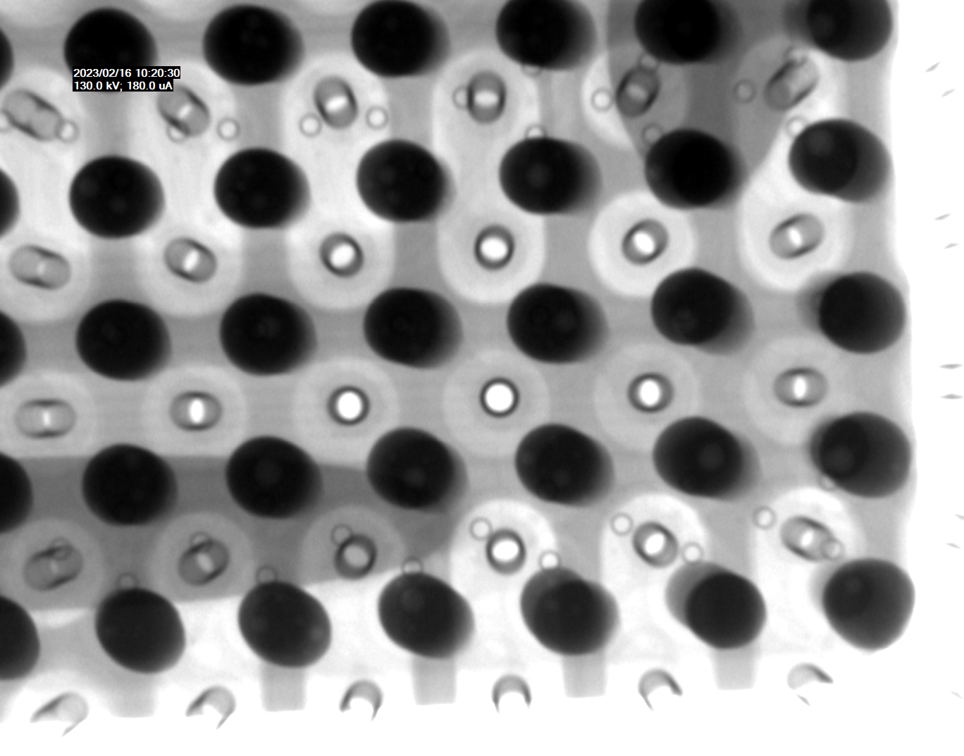 2D Röntgenbild 2D Röntgenbild