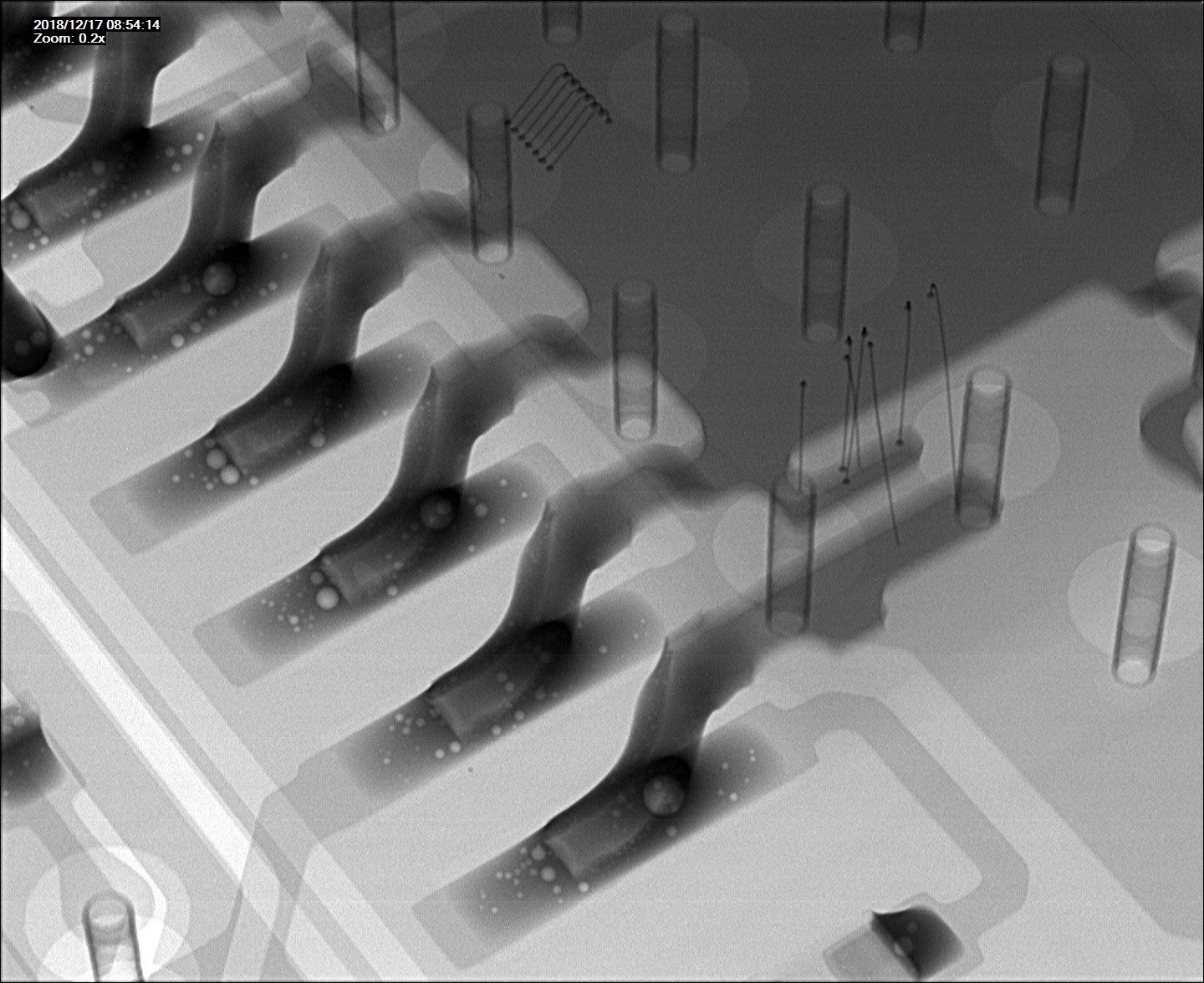 X-ray image of solder joints