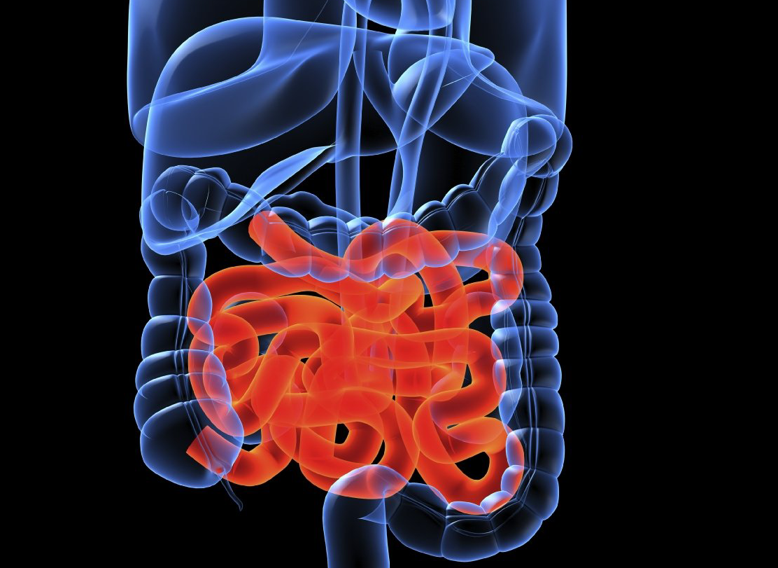 Die Darmsanierung / Ernährungstherapie ist eine Domäne der Naturheilpraxis Albat