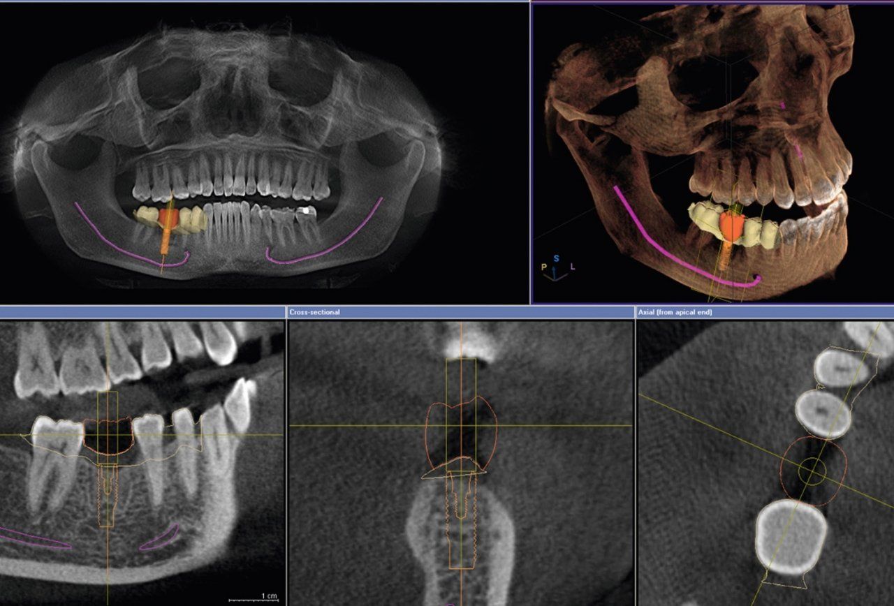 DVT-Diagnostik 3D-Röntgen Zahnärztin Sabine Leiber Bremen-Nord DVT-Diagnostik 3D-Röntgen Zahnärztin Sabine Leiber Bremen-Nord