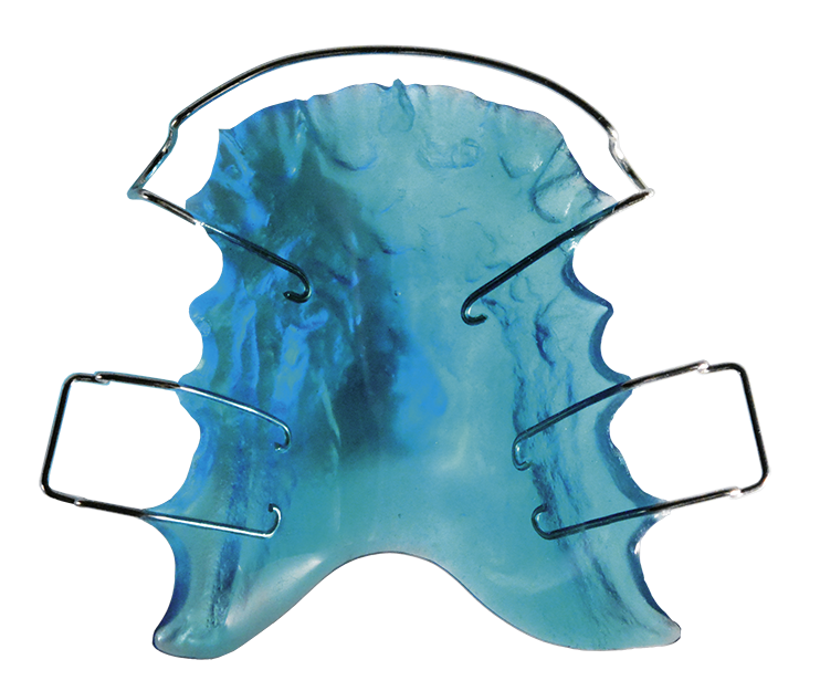 Herausnehmbare Spangen