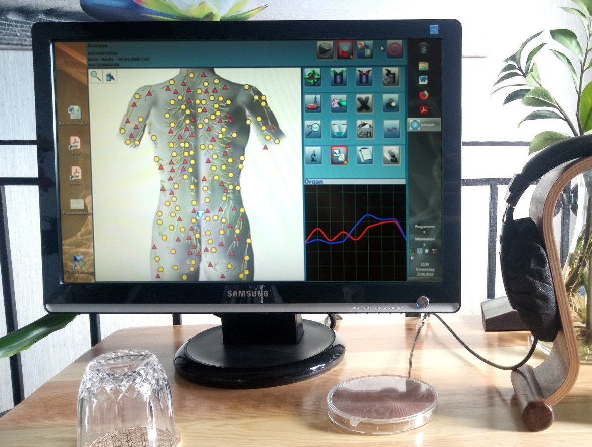 Bioresonanz in Pottendorf Oberon Gerät