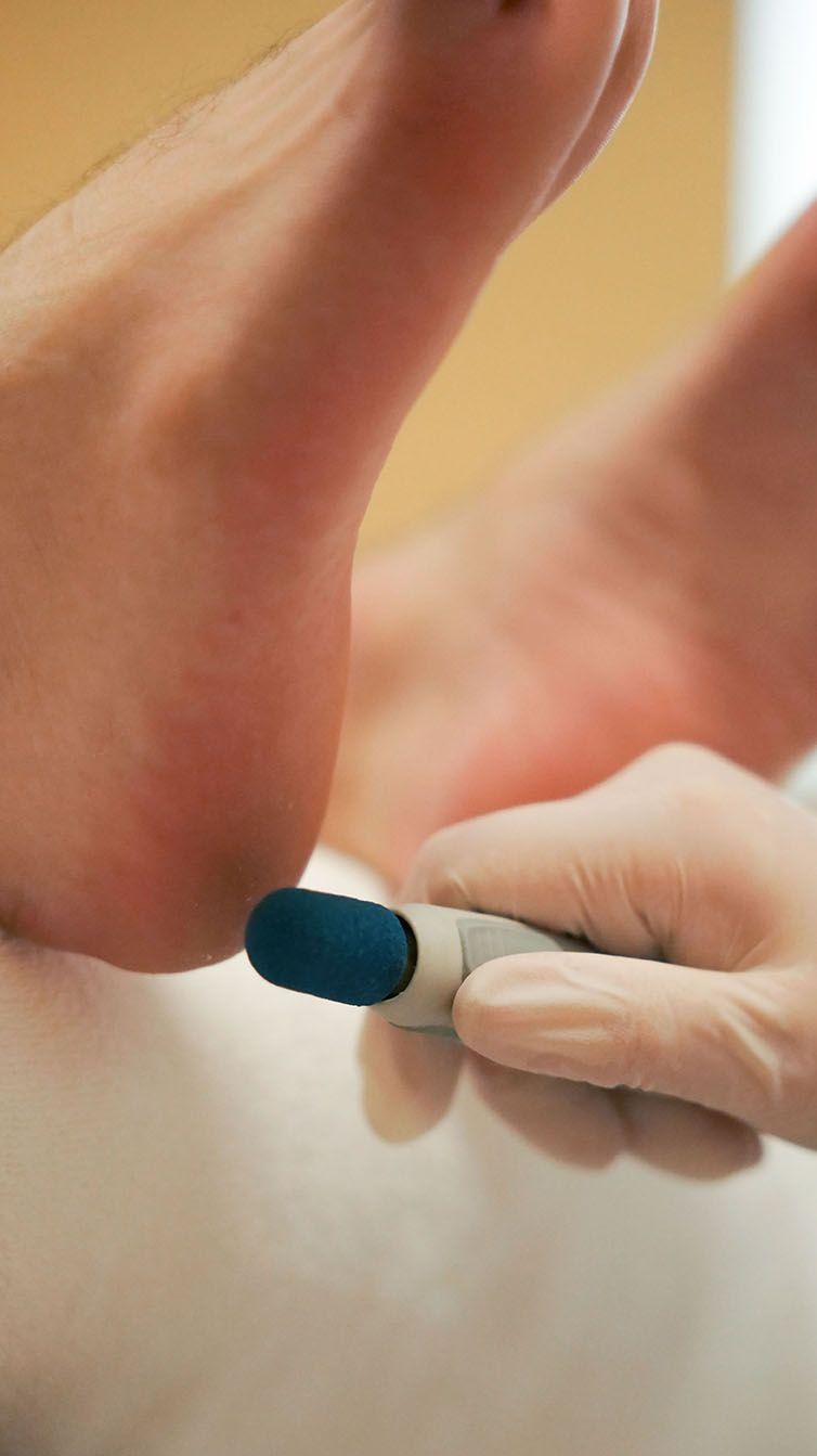 Nagelkorrekturen und Nagelspangen – mit der Orthonyxie-Methode bei Karin Kehrwecker