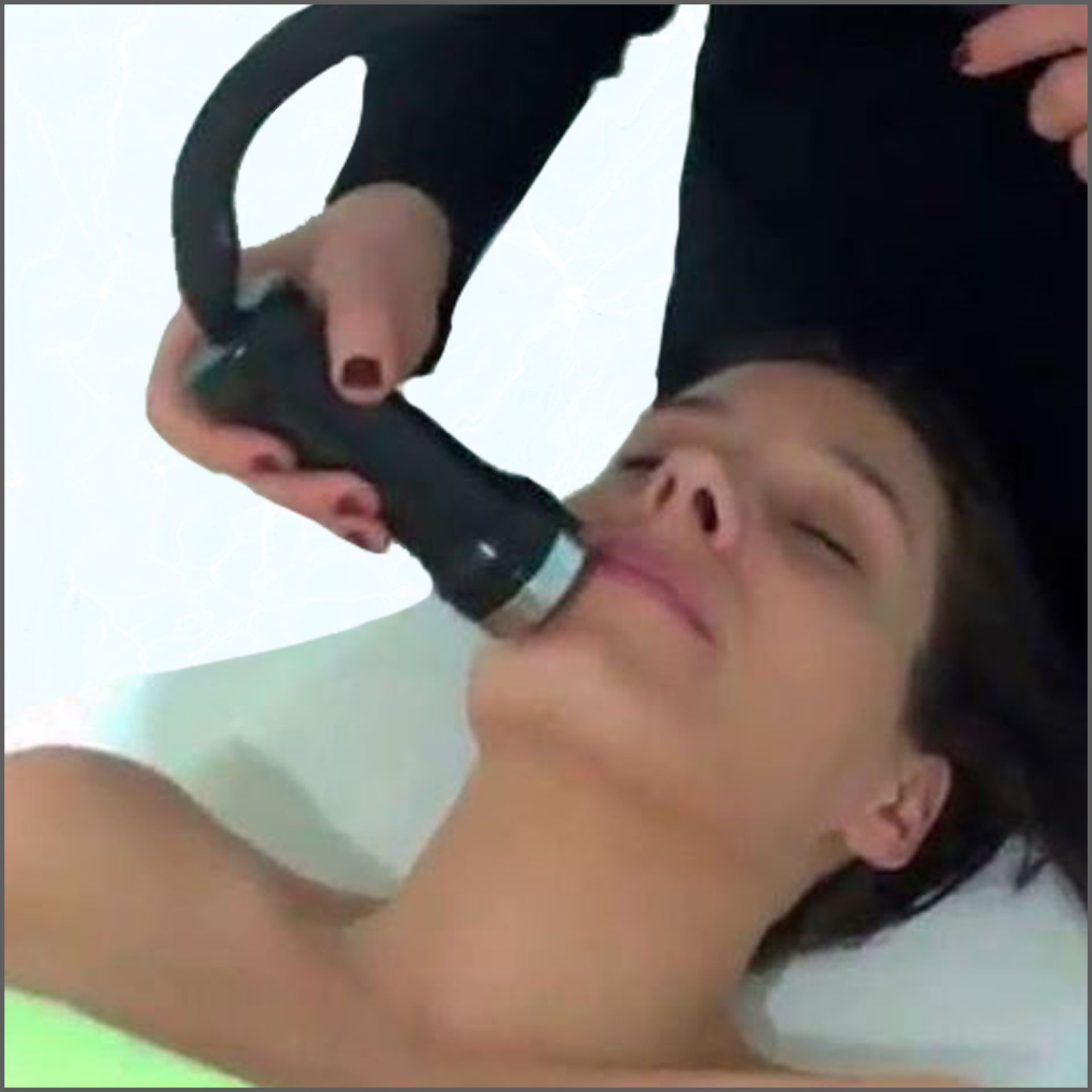 Traitement réalisé avec un Applicateur de Contraste Thermique Direct sur le visage.