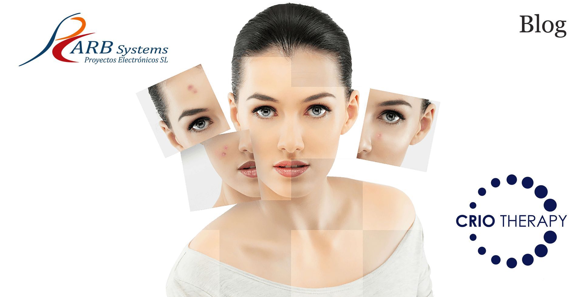 Rostro de mujer seccionado en varios planos con imperfecciones de la piel como acné, tratable con aparatología estética aplicando tratamiento de frío controlado.