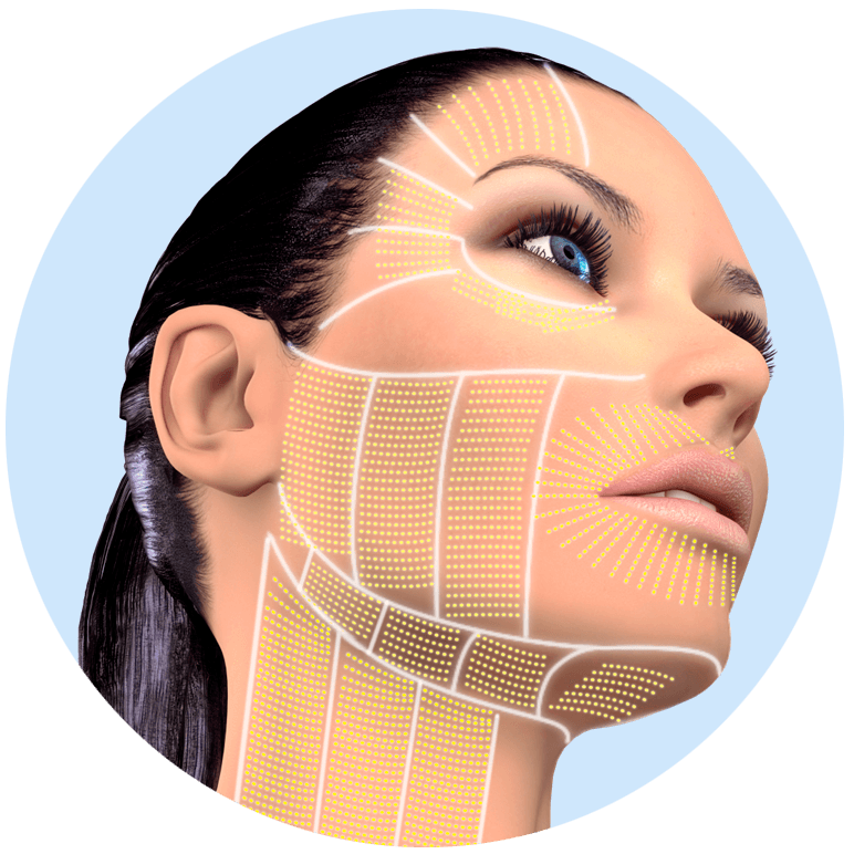 CRYO FACIAL AESTHETICS Professional facial aesthetic equipment, the image shows a woman's face with areas that can be treated with localized cold.