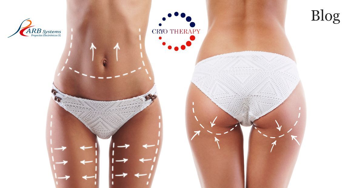 Mujer de frente y de espaldas con flechas en zonas tratables con aparatología estética aplicando Criolipolisis.