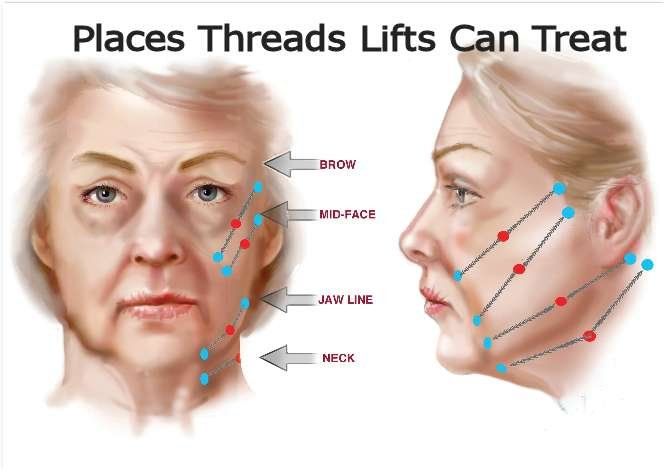 places for pdo threads