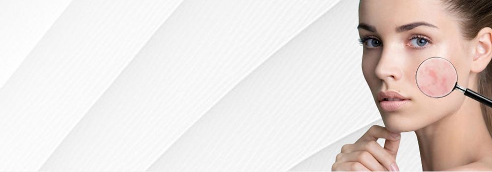 dermaconcept Hautanalyse