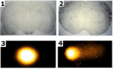 Mobilfunk Schadstoffe für das Gehirn