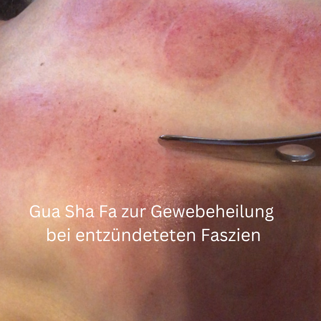MHR® Myofasziale Schmerz Therapie