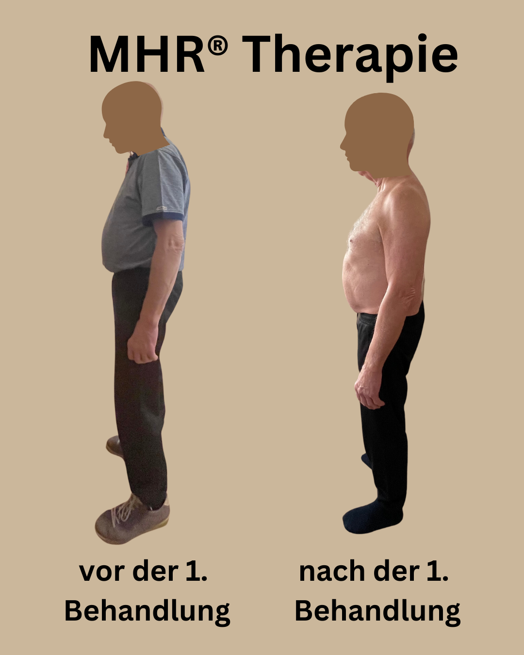MHR® Myofasziale Schmerztherapie vor und nach er ersten Behandlung