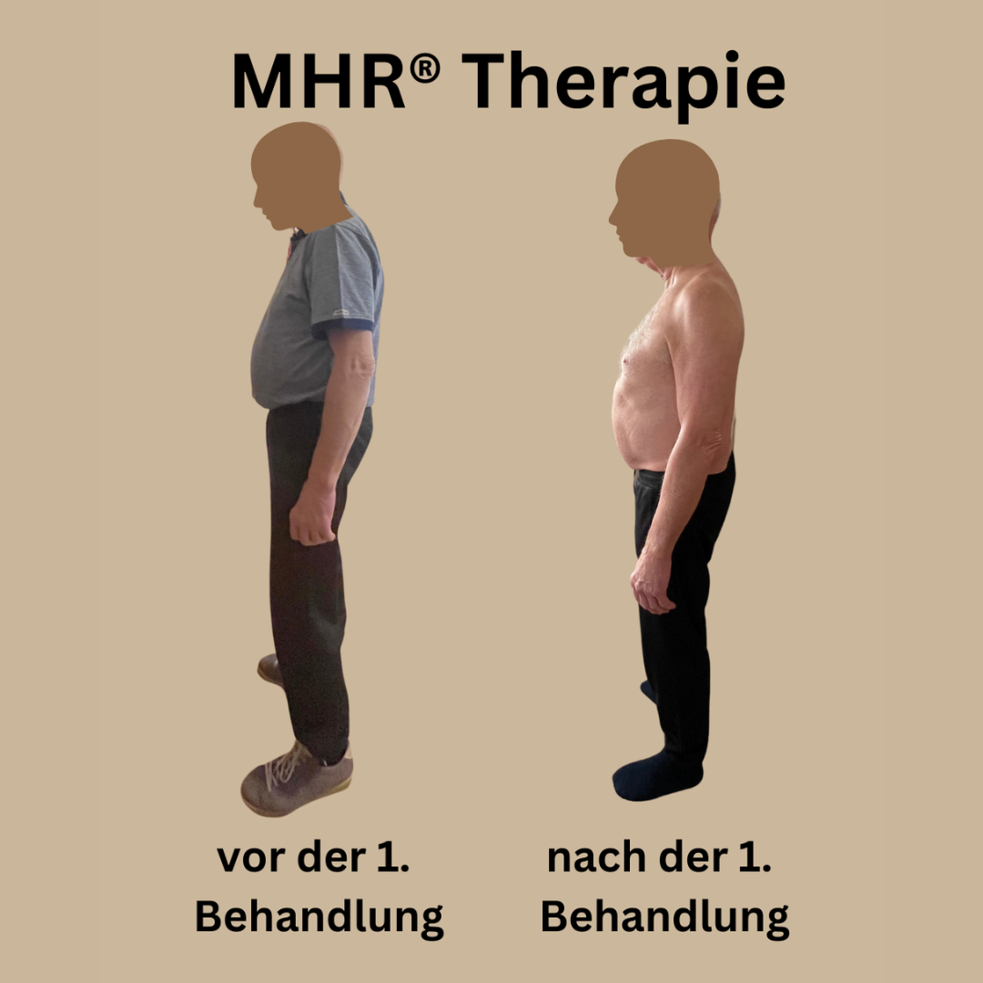 MHR® Myofasziale Schmerztherapie, vor und nach der ersten Behandlung