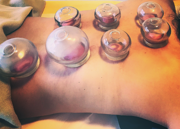 Schröpfen, Schröpfmassage