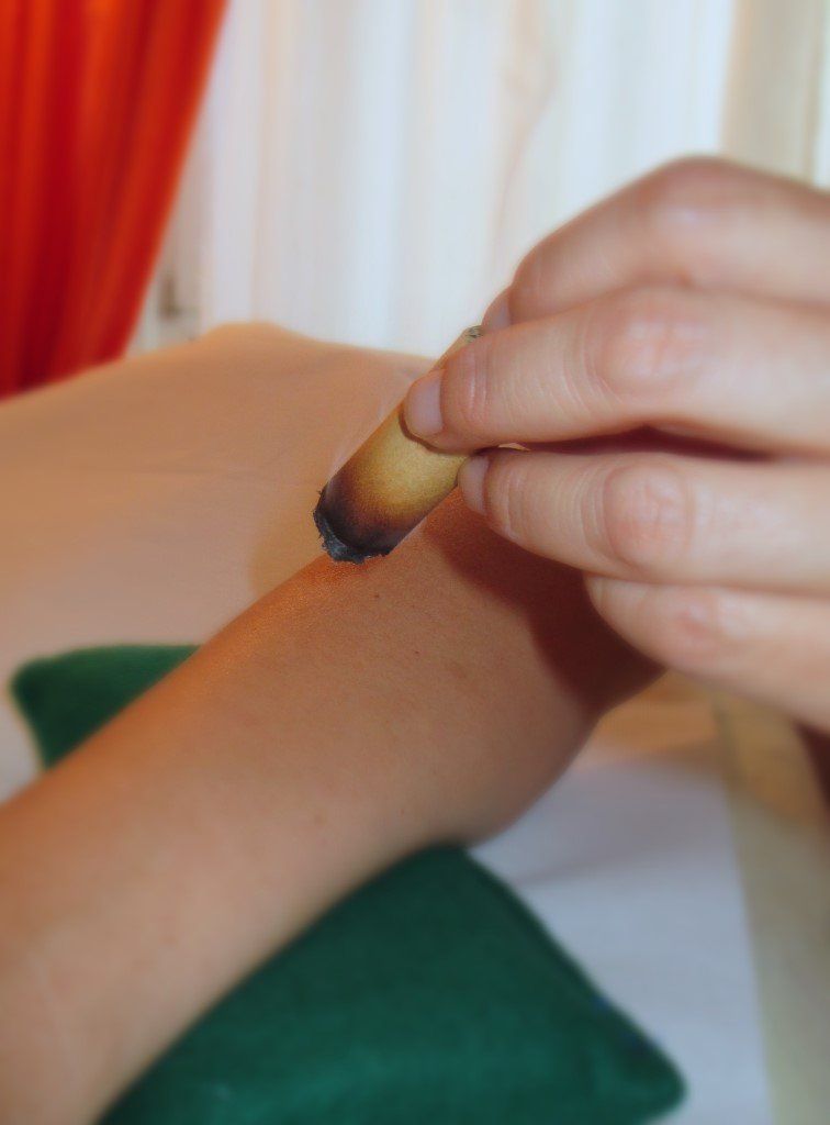 Moxibustion mit Moxa-Zigarren, Beifußkraut