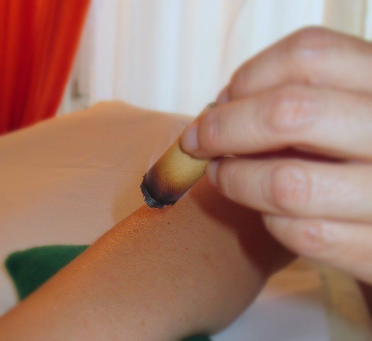 Wärmebehandlung mittels einer Moxakraut-Zigarre