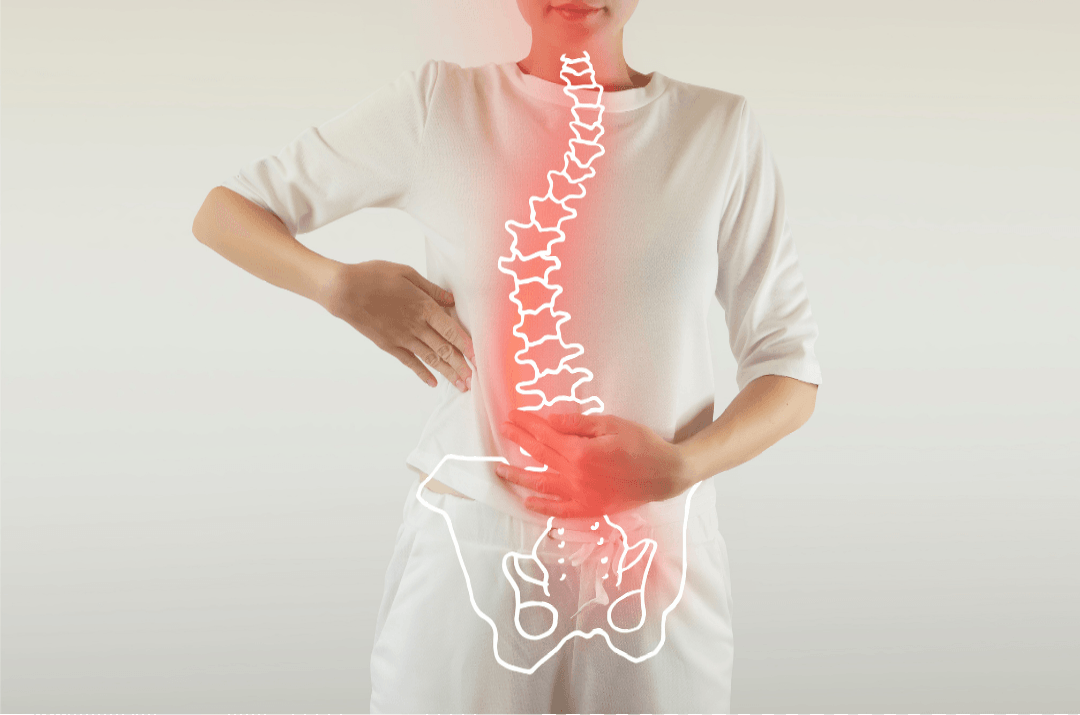 musculatura abdominal en escoliosis